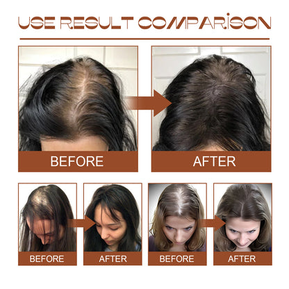 ✨ Après-Shampoing Nourrissant Batana Oil – Cheveux Souples, Forts et Épais